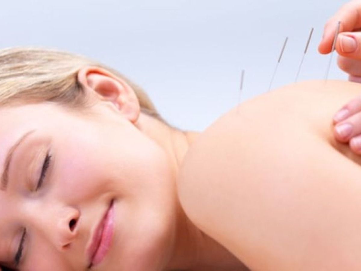 Facial Rejuvenation Acupuncture