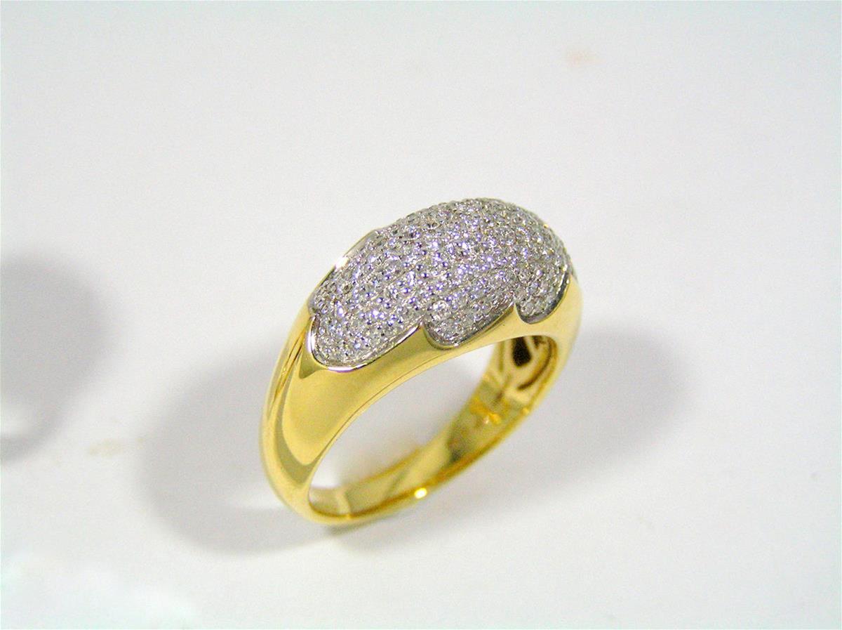 Rhodium Plating Same Day photo